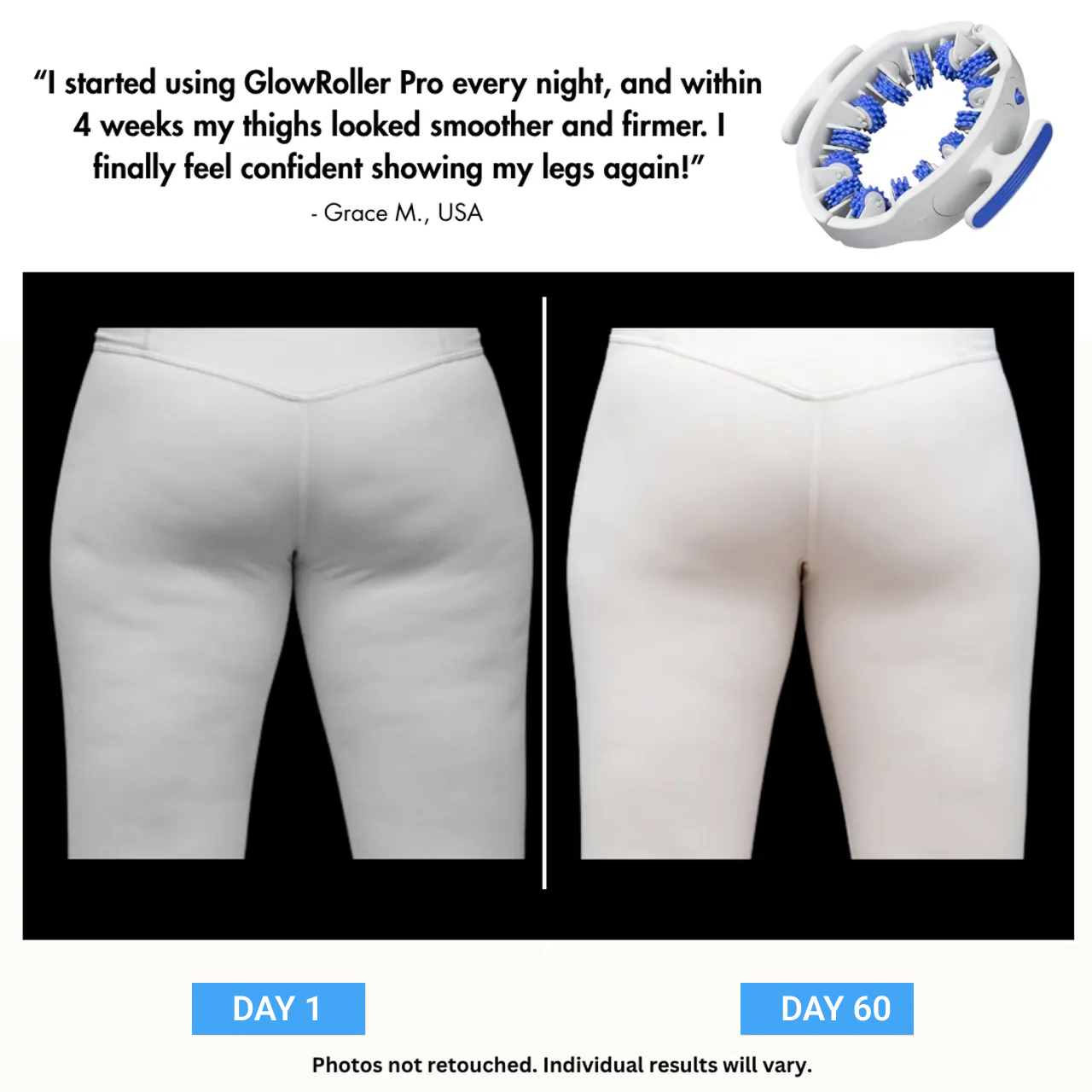 Veyora™ - MyoGlide Pro