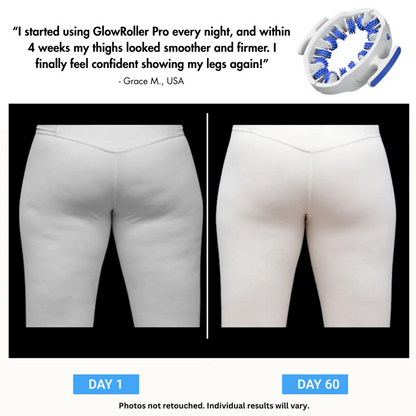 Veyora™ - MyoGlide Pro